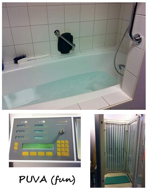 PUVA